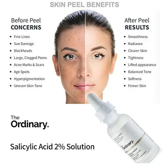 The Ordinary salicylic acid 2% Solution